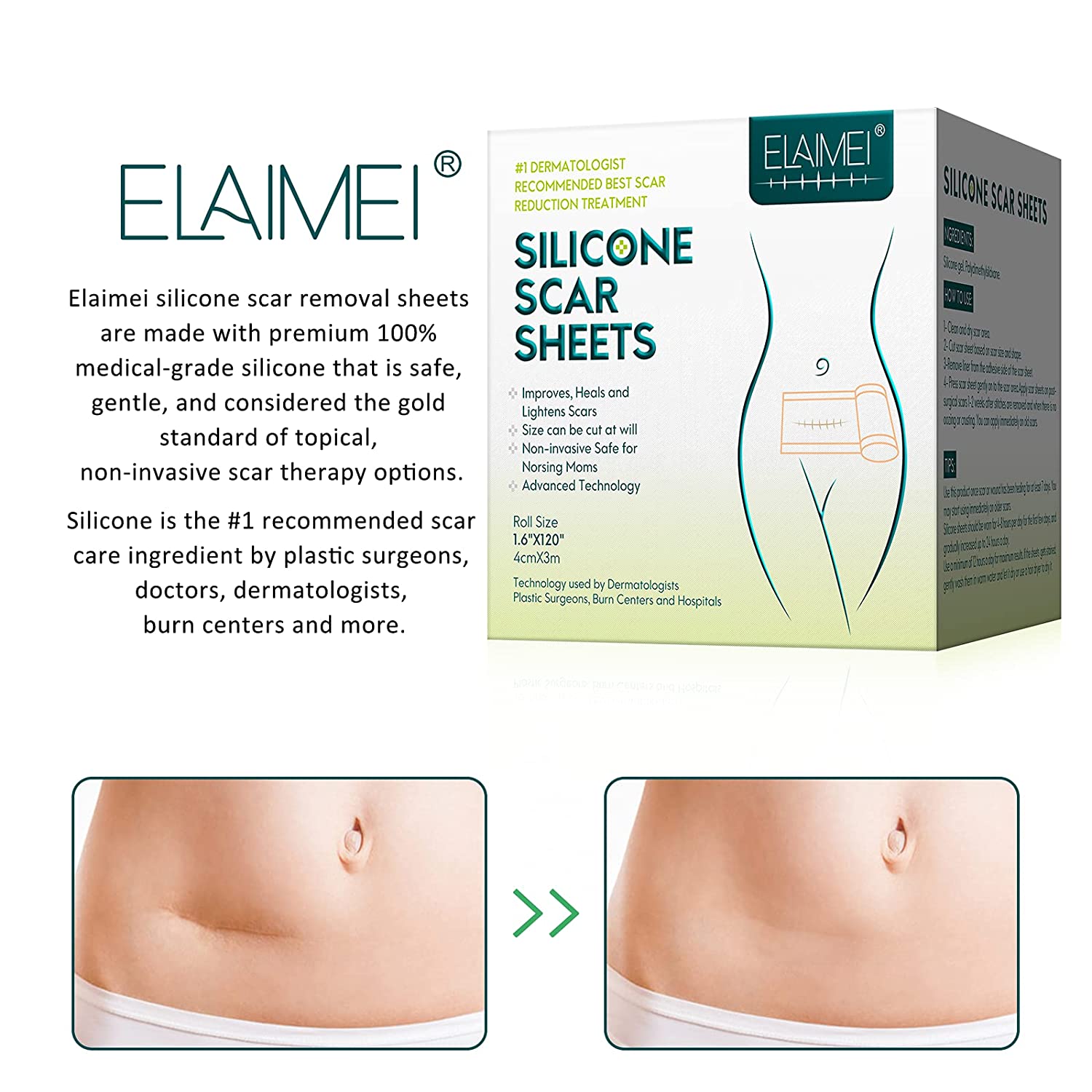 Silicone gel deals pads for scars